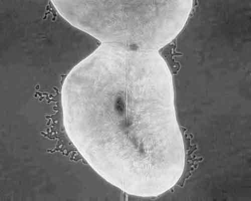 X. fastidiosa isolate WM1-1 from a Mourvedre grapevine in Dahlonega, Georgia